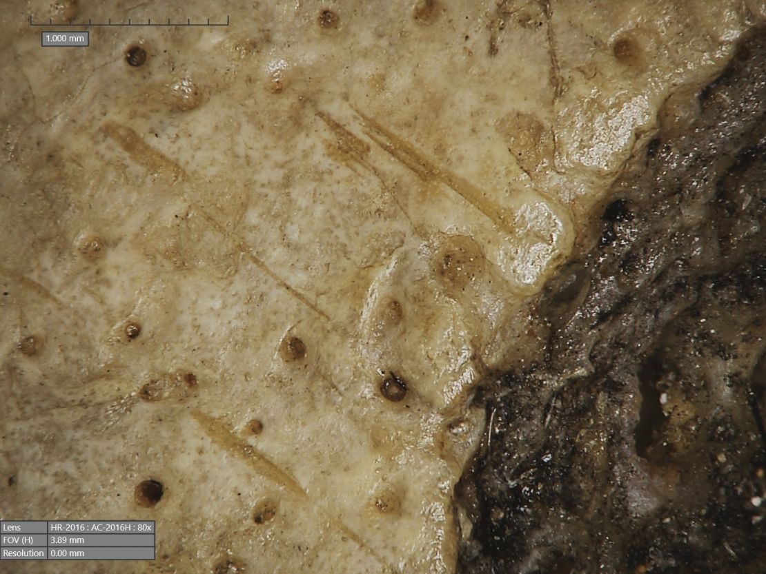 Several of the metastatic lesions in the skull 236 show cut marks.  A close-up of cut marks, probably made with a sharp object, is shown.