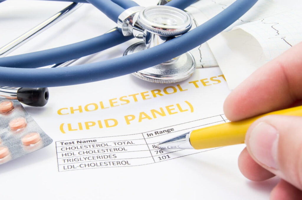 Millions of Americans already have high cholesterol in their 20s and 30s – and don't know it.  Here's why this worries doctors.