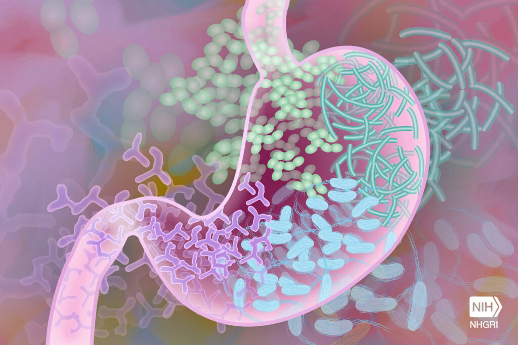 Study links changes in gut microbiome to increased risk of type 2 diabetes