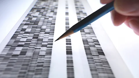 Getty Images A scientist examines a DNA gel (Getty Images)