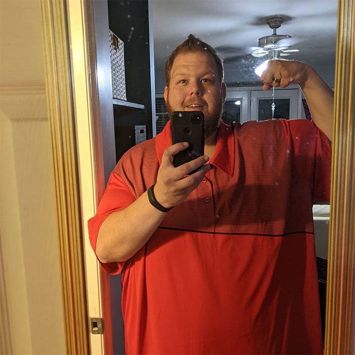 Man Raises $76,000 to Surgically Remove Excess Skin After Huge Weight Loss Transformation