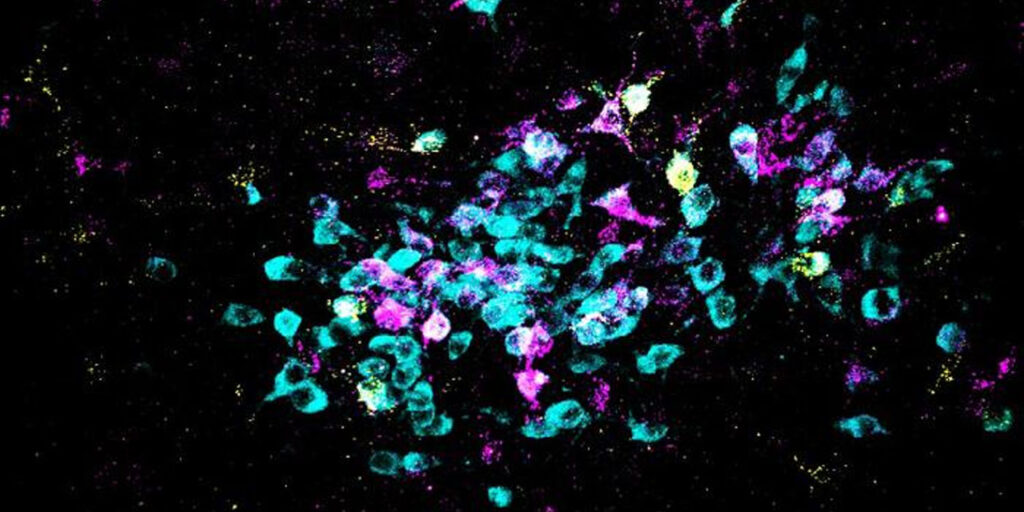 Neurons are shown in cyan and retrograde tracers shown in yellow and magenta. (Spitzer Lab, UC San Diego)