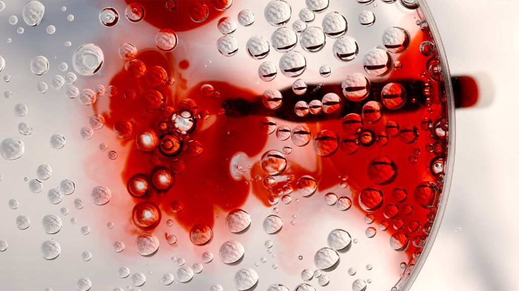 Close-up of a blood sample analyzed in a petri dish.