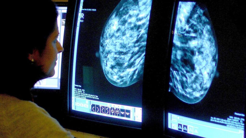 Why breast cancer is more likely to come back than any other type