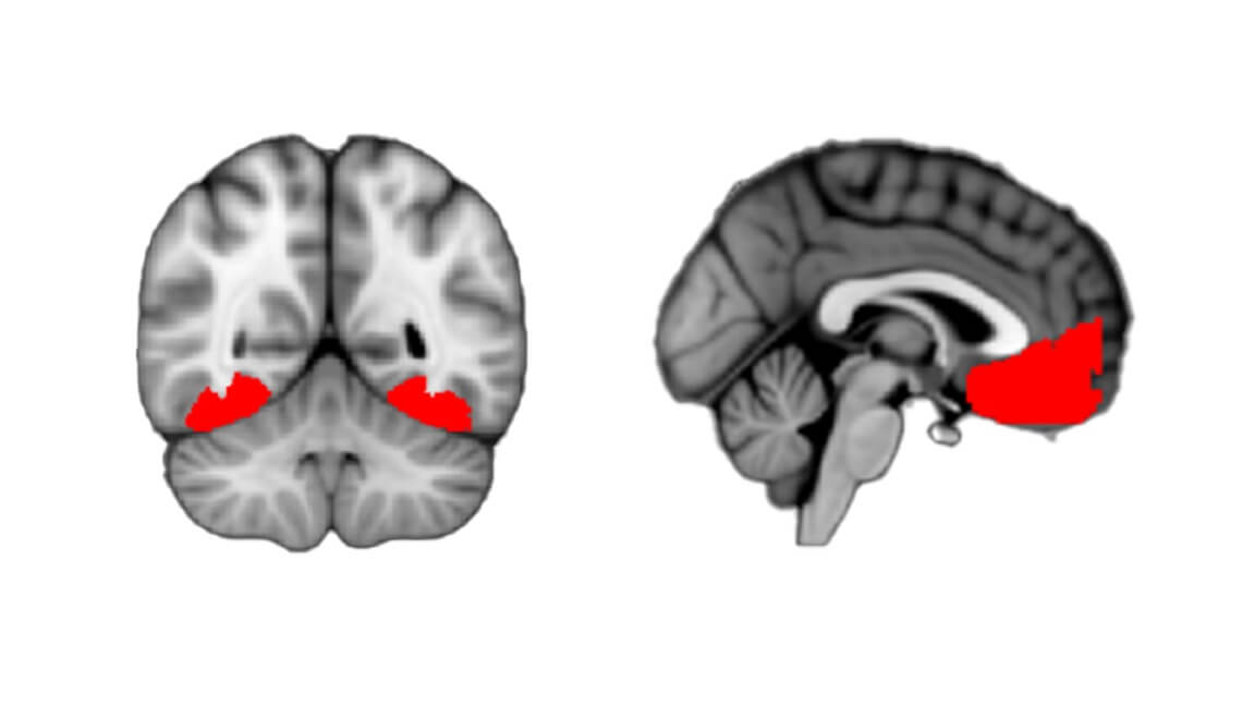 Human brain scan images show regions toward the back and front that are active in a curious person.