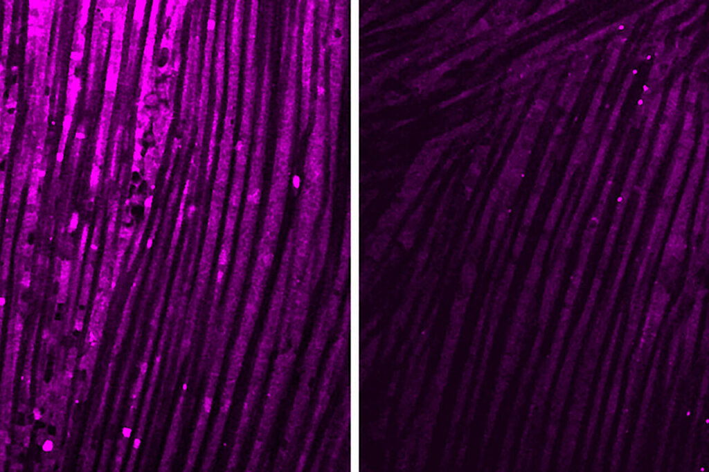 Scientists identify possible way to block muscle fatigue in long COVID and other diseases