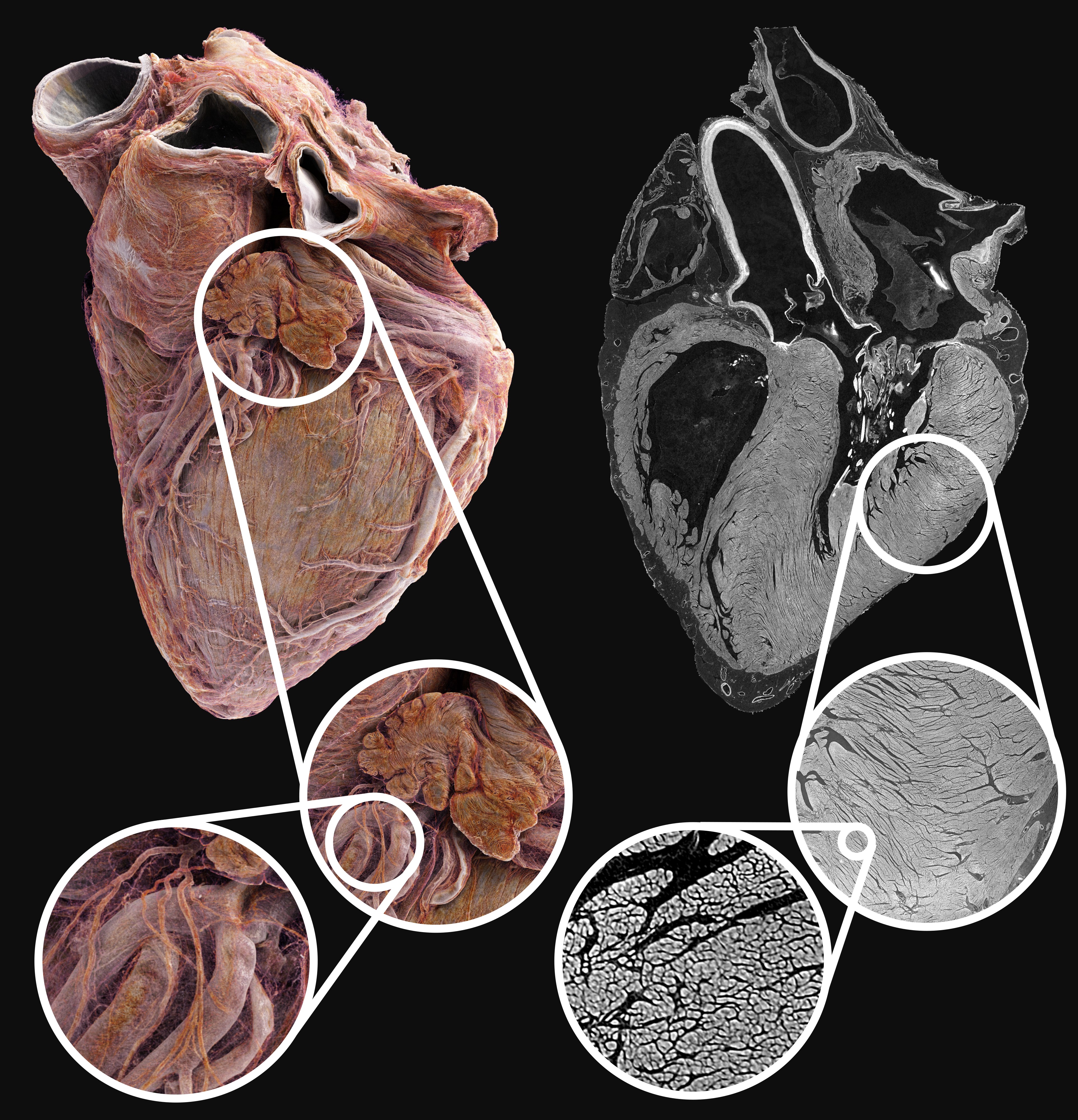 Rendering and cross sections of hearts