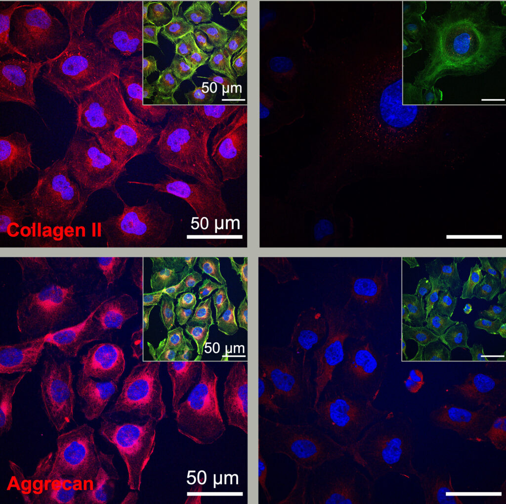 New study shows 'dancing molecules' can regenerate cartilage in 3 days