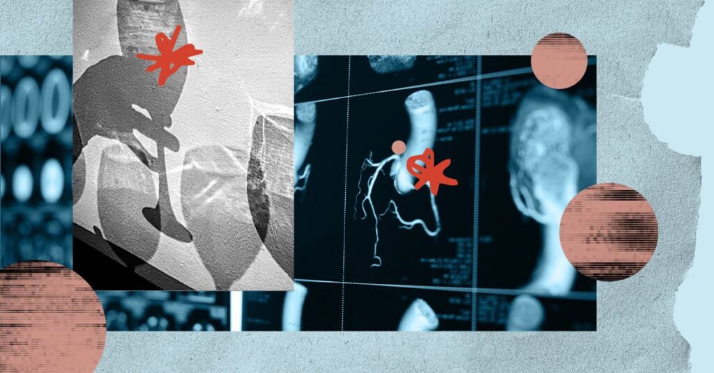 What is the real effect of alcohol consumption on the heart?