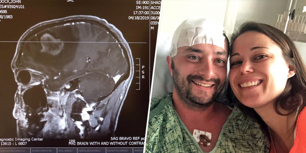 35-year-old man diagnosed with glioblastoma after single symptom