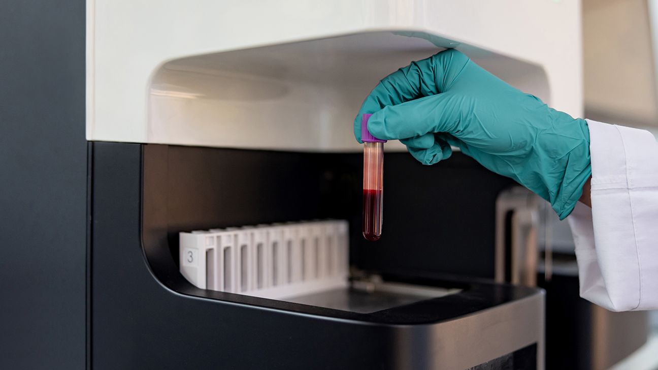 A lab technician retrieves a vial of blood.