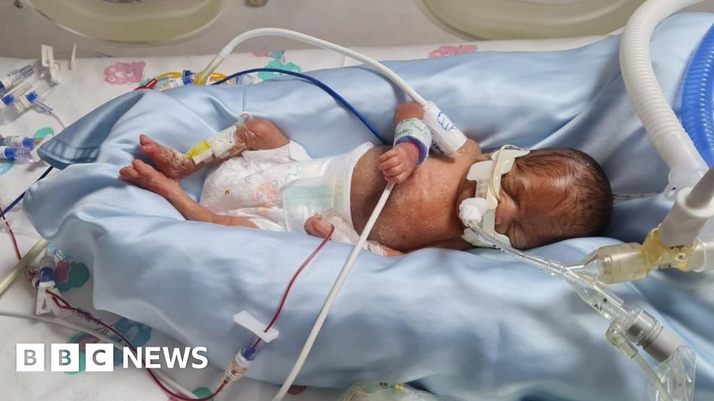 Baby deaths from virus spread could have been prevented - BBC News