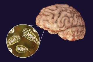 A scientific illustration showing a brain and a close-up of an amoeba of the species Naegleria fowleri