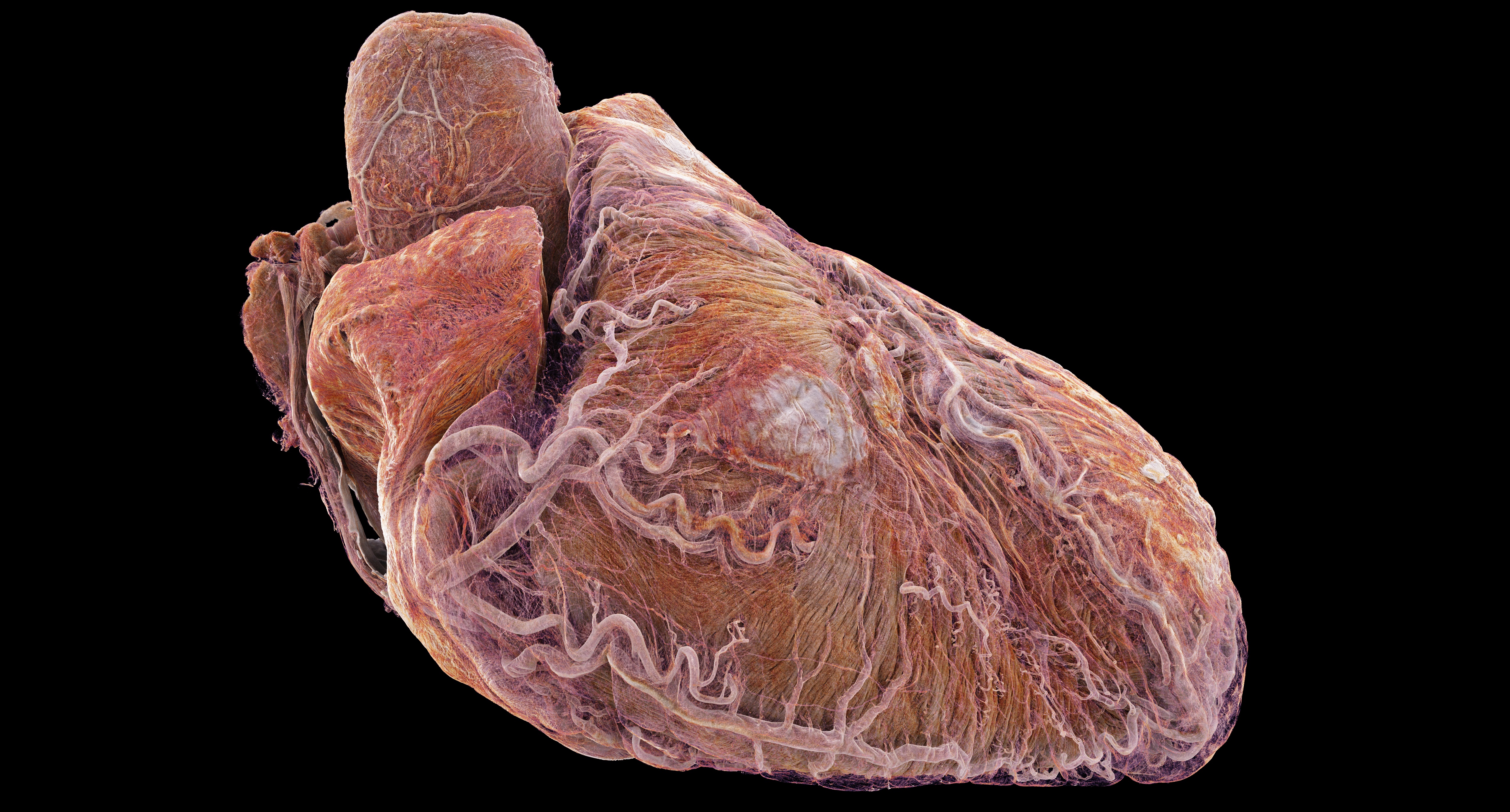 A healthy heart with “unprecedented 3D detail”