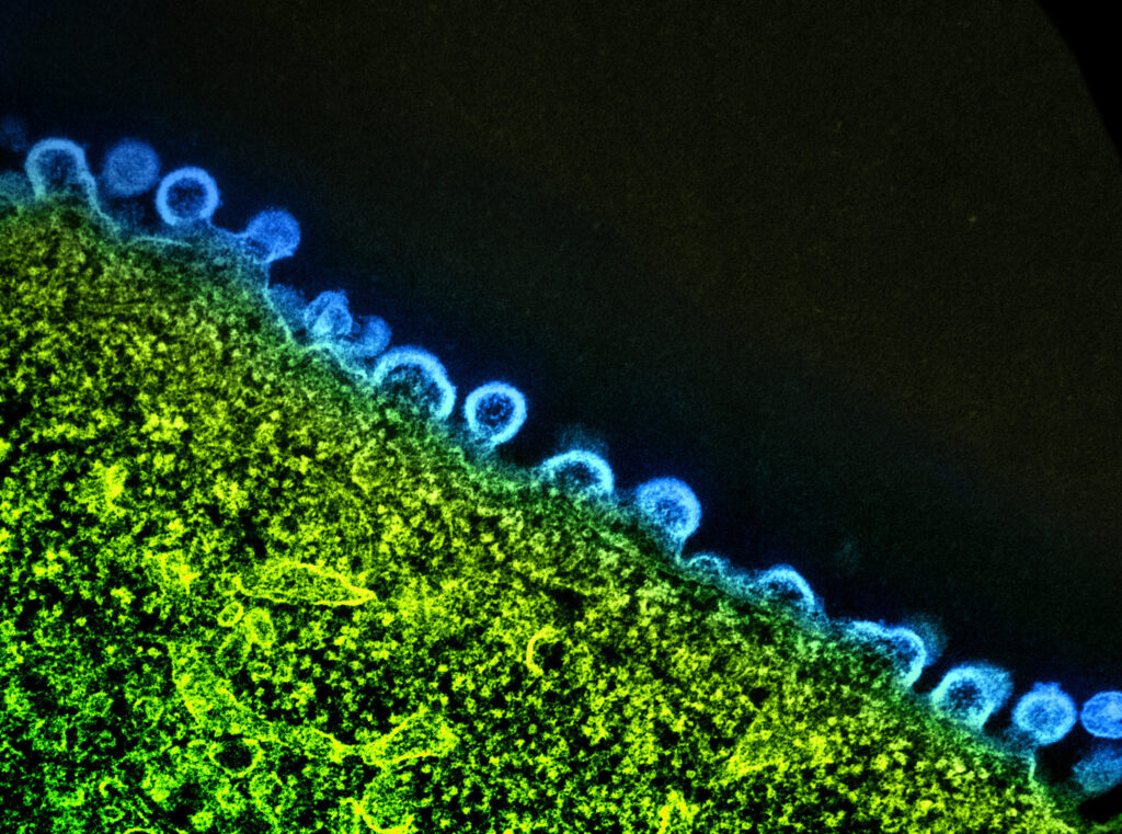 Isolated viral load testing may produce false positive results in people using long-acting PrEP