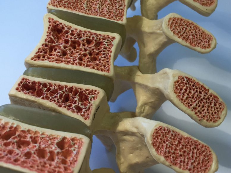 Anatomy of Osteoporosis