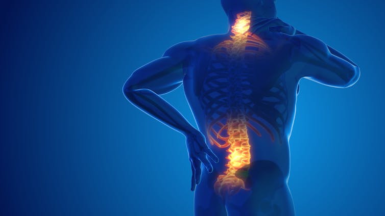 Three-dimensional illustration of back and neck pain, with painful areas illuminated against a dark background.