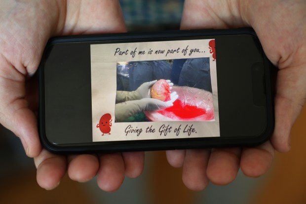 John Nicholas displays a photo on his phone of a living donor kidney he received from a friend for a transplant. (John J. Kim/Chicago Tribune)