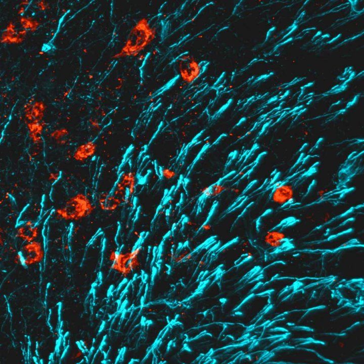 A microscopic image showing the presence of maternal brain hormone, also known as CCN 3, in the brain.