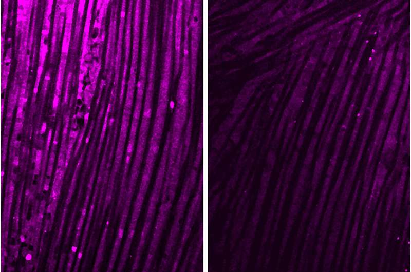 Brain inflammation causes muscle weakness after infections