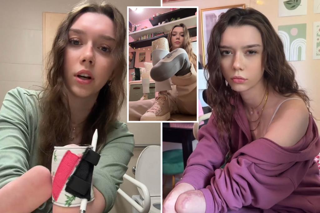 Teenage Girl Wakes Up From Coma To Learn She Will Soon Have Four Limbs Amputated